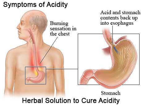 Acidity Treatment